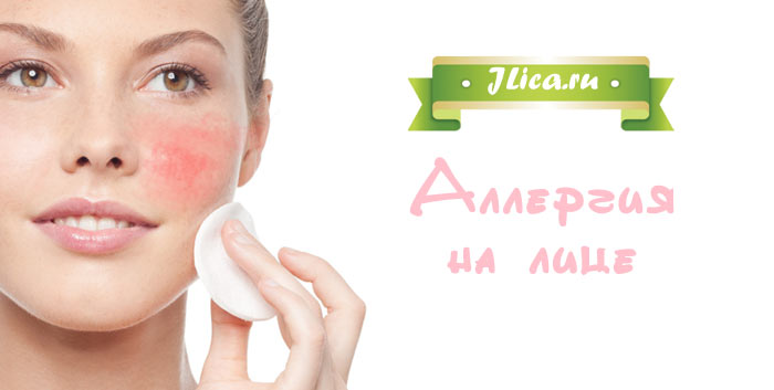 Аллергические прыщи на лице: причины, виды, лечение