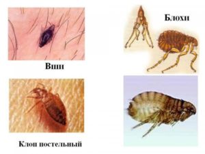 Чем отличаются вши от блох и как выглядят внешне