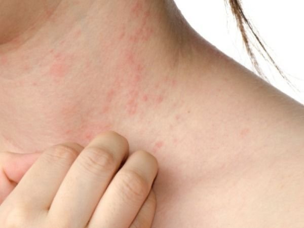 Черные точки на теле: два основных вида образований