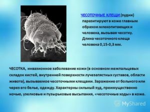 Чесоточный клещ у человека