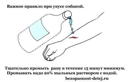 Что делать, если укусила собака?