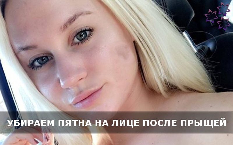 Как быстро убрать воспаленный прыщ: рекомендации по уходу