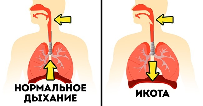 Как избавиться от икоты