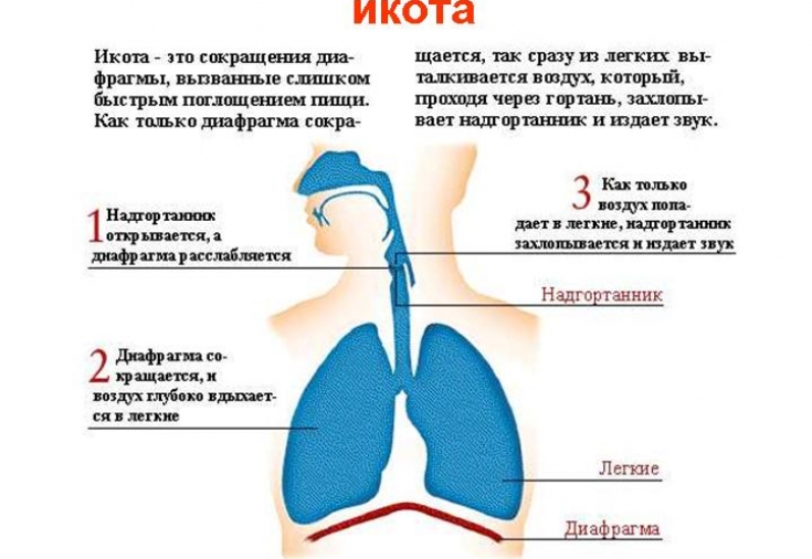 Как избавиться от икоты