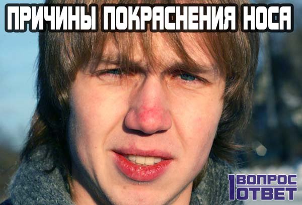 Красный нос: причины появления болезни и способы лечения