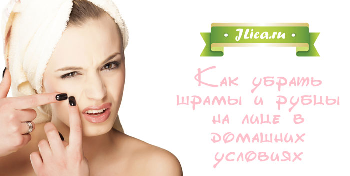 Лимон от постакне: как избавиться от шрамов в домашних условиях