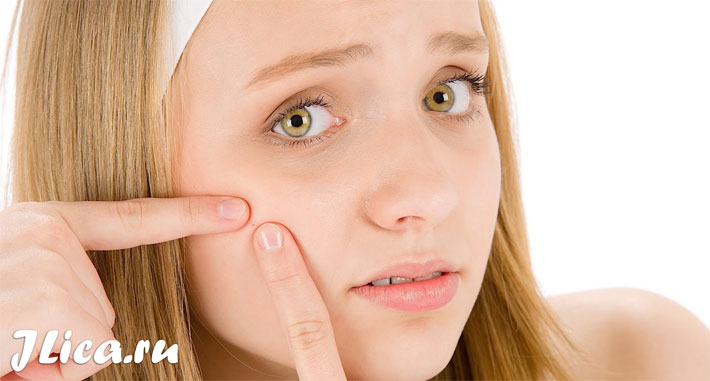 Мыло от прыщей: рецепты, отзывы об использовании продукта