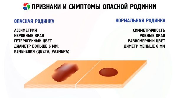 На родинке появились черные точки – причины и диагностика явления