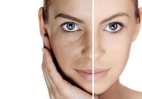 Препараты с ретиноидами: помогают ли они от прыщей