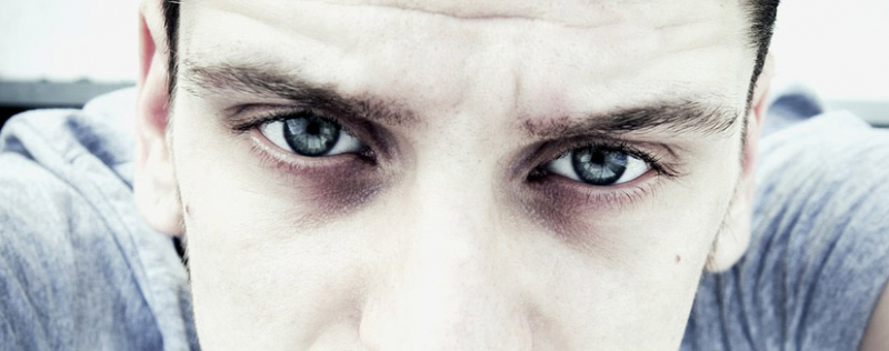 Причины прыщей между бровями, в зависимости от вида