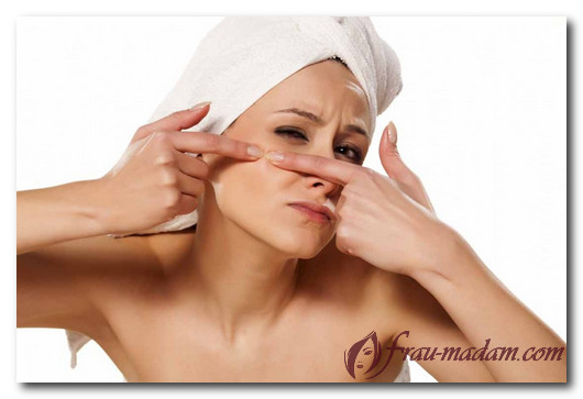 Прыщи на теле женщины: причины, диагностика, к какому врачу обратиться