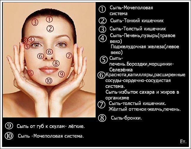 Прыщи от алкоголя: конкретные причины появления и лечение