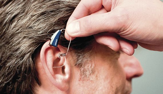Топ-12 лучших слуховых аппаратов — как подобрать самостоятельно, рейтинг лучших моделей с описанием и стоимостью