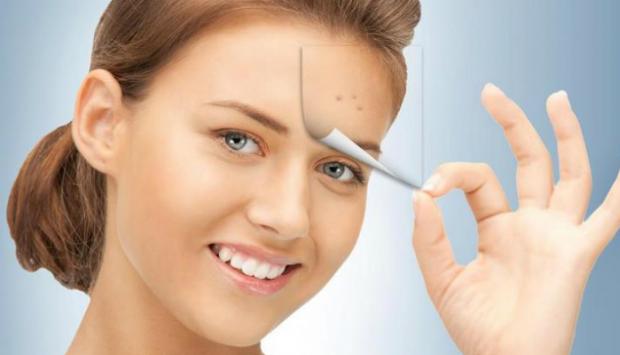 Узнай, как избавиться от прыщей и улучшить состояние кожи