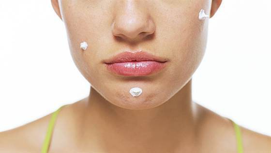 Зубная паста от прыщей: миф или правда?